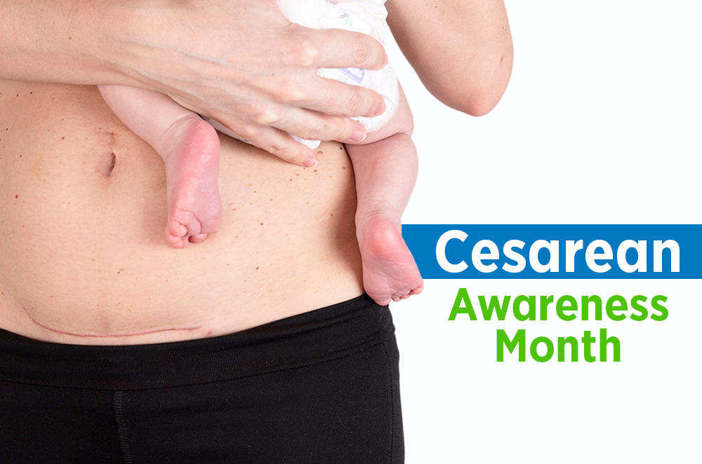 Cesarean Awareness Month