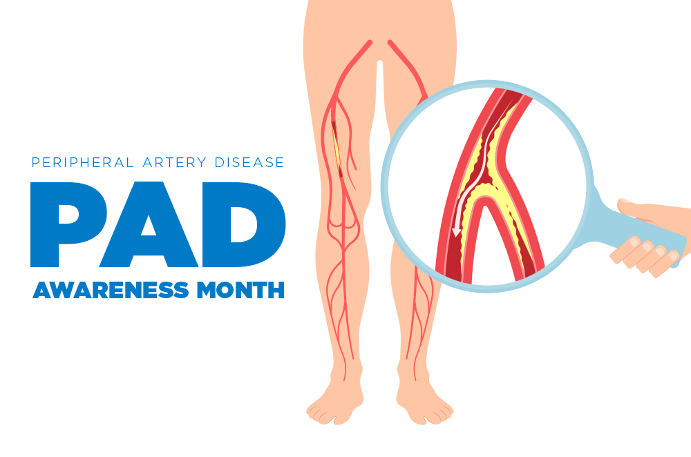 September is Peripheral Artery Disease Awareness Month