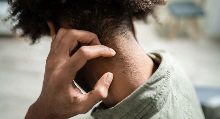 blog-post-template-720×390 Man scratching his neck